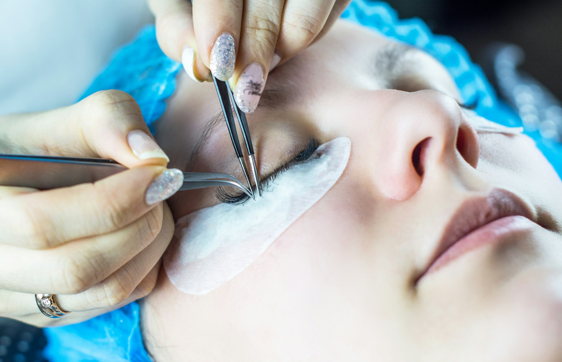 Close-up of a precise electrolysis treatment in progress
